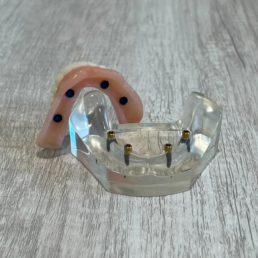 snap-in implant dentures Bartow, FL